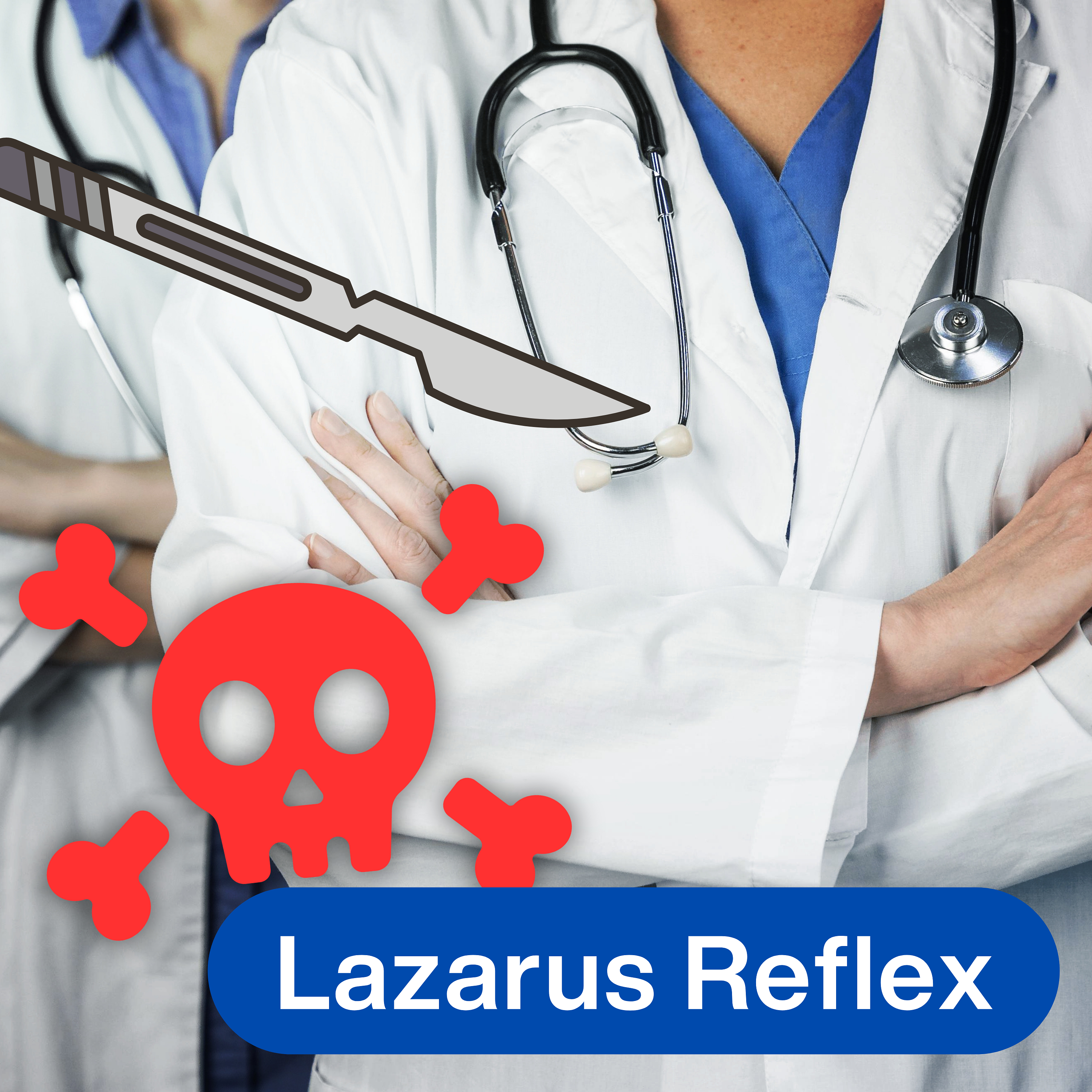 Lazarus Reflex