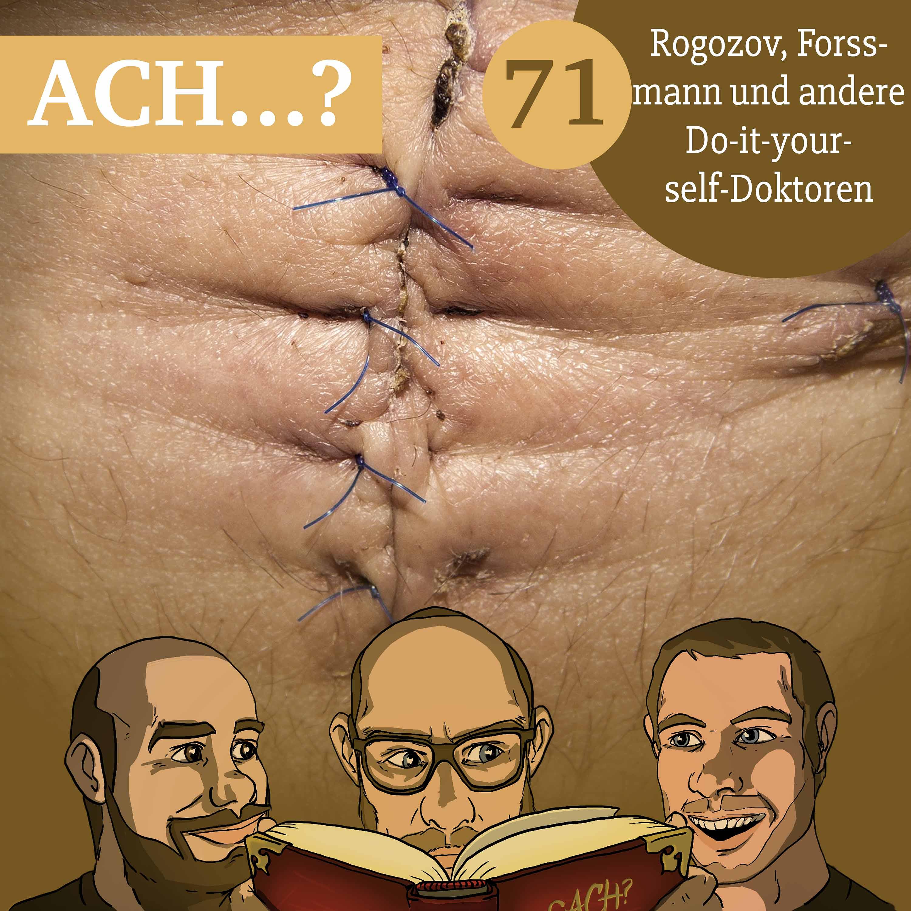 71 – Rogozov, Forssmann und andere Do-it-yourself-Doktoren episode artwork